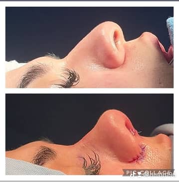 Slider image (5) Aesthetic and Oncologic Face, Head and Neck Clinic and OR